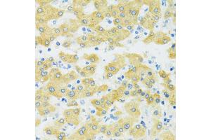 Immunohistochemistry of paraffin-embedded human liver using SLC37A4 antibody. (SLC37A4 Antikörper)