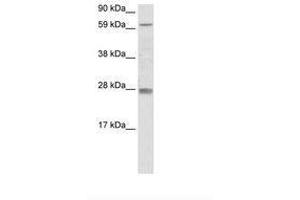 Image no. 1 for anti-Reproductive Homeobox 11 (RHOX11) (AA 61-110) antibody (ABIN6736075) (RHOX11 Antikörper  (AA 61-110))