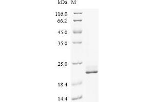 (Tris-Glycine gel) Discontinuous SDS-PAGE (reduced) with 5 % enrichment gel and 15 % separation gel.