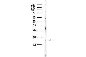 anti-Crumbs Homolog 3 (CRB3) antibody