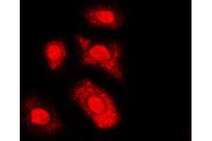 Immunofluorescent analysis of AKT (pT308) staining in HL60 cells. (AKT1 Antikörper  (pSer308))