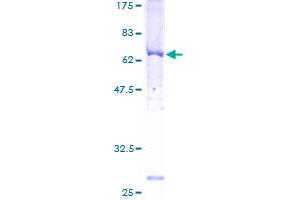 Image no. 1 for Adrenergic, Beta, Receptor Kinase 2 (ADRBK2) (AA 1-387) protein (GST tag) (ABIN1344494) (ADRBK2 Protein (AA 1-387) (GST tag))