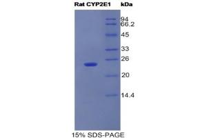 SDS-PAGE analysis of Rat CYP2E1 Protein. (CYP2E1 Protein)