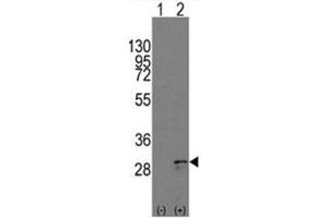 Image no. 2 for anti-KIT Ligand (KITLG) (C-Term) antibody (ABIN357009) (KIT Ligand Antikörper  (C-Term))