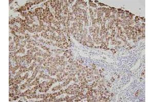 Immunohistochemistry of human liver tissue was incubated with AK3 monoclonal antibody , clone SJB3 - 36 (1 : 100)  for 2 hours at room temperature. (Adenylate Kinase 3 Antikörper)