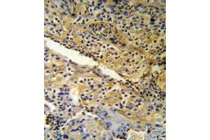 SPINK5 Antibody (N-term) (R) IHC analysis in formalin fixed and paraffin embedded human tonsil tissue followed by peroxidase conjugation of the secondary antibody and DAB staining.