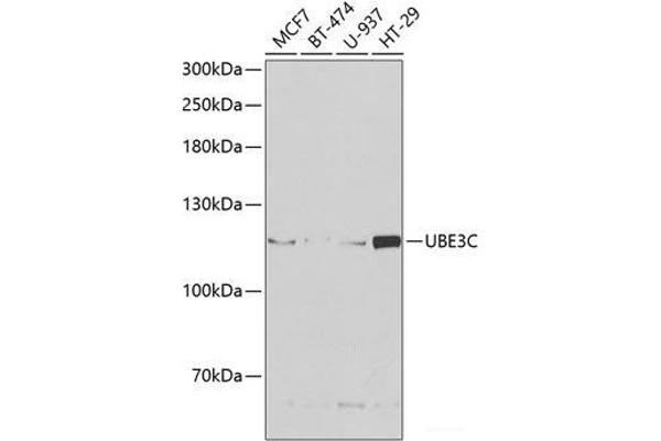 UBE3C 抗体