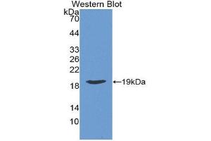 Western Blotting (WB) image for anti-Retinoic Acid Receptor Responder (Tazarotene Induced) 2 (RARRES2) (AA 21-155) antibody (ABIN1862319) (Chemerin Antikörper  (AA 21-155))