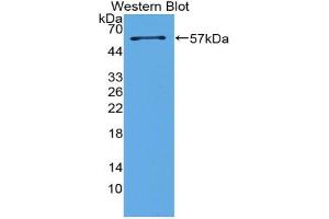 Western blot analysis of the recombinant protein. (Surfactant Protein A1 Antikörper  (AA 21-248))