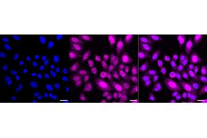 anti-Budding Uninhibited By Benzimidazoles 1 Homolog beta (Yeast) (BUB1B) antibody