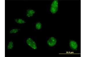 Immunofluorescence of purified MaxPab antibody to NARG2 on HeLa cell. (NARG2 Antikörper  (AA 1-332))