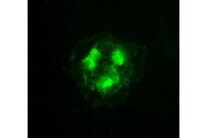 Anti-CDK5 mouse monoclonal antibody (ABIN2452276) immunofluorescent staining of COS7 cells transiently transfected by pCMV6-ENTRY CDK5 (RC200342). (CDK5 Antikörper)
