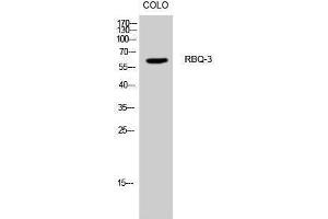 Western Blotting (WB) image for anti-Retinoblastoma Binding Protein 5 (RBBP5) (Internal Region) antibody (ABIN3177167) (RBBP5 Antikörper  (Internal Region))