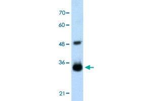 Western Blot analysis of transfected 293T cell lysate with HOXC9 polyclonal antibody  at 2.
