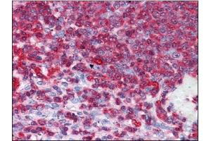 Human Spleen: Formalin-Fixed, Paraffin-Embedded (FFPE) (GDI2 Antikörper)