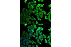 Immunofluorescence analysis of U2OS cells using Septin 2 antibody (ABIN6128758, ABIN6147552, ABIN6147553 and ABIN6221486). (Septin 2 Antikörper  (AA 112-361))