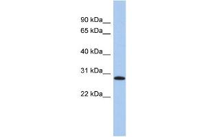 WB Suggested Anti-LYSMD1 Antibody Titration: 0. (LYSMD1 Antikörper  (N-Term))