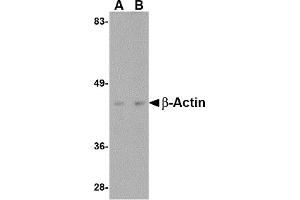 Western Blotting (WB) image for anti-Actin, beta (ACTB) (C-Term) antibody (ABIN1030291) (beta Actin Antikörper  (C-Term))