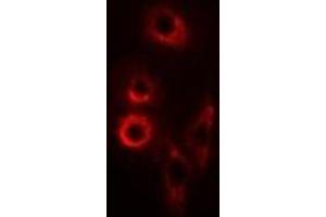Immunofluorescent analysis of SMAC staining in SW620 cells. (DIABLO Antikörper)