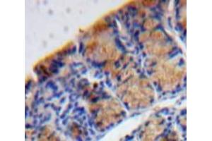 Used in DAB staining on fromalin fixed paraffin-embedded Bowels tissue (MANF Antikörper  (AA 28-182))
