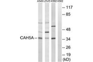 Western blot analysis of extracts from A549/LOVO/K562 cells, using CA5A Antibody. (CA5A Antikörper  (AA 171-220))