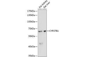 Western blot analysis of extracts of various cell lines, using CYP27B1 antibody (ABIN6130955, ABIN6139327, ABIN6139328 and ABIN6218814) at 1:3000 dilution. (CYP27B1 Antikörper  (AA 25-195))