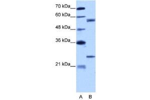 WB Suggested Anti-CPNE1  Antibody Titration: 5. (CPNE1 Antikörper  (N-Term))