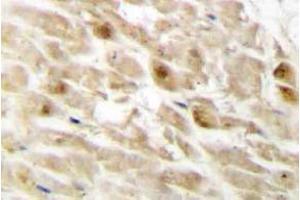 Immunohistochemistry (IHC) analyzes of PEBP2beta antibody in paraffin-embedded human heart tissue. (CBFB Antikörper)