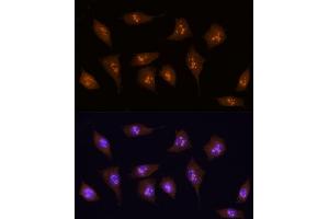 Immunofluorescence analysis of L929 using KDM5B antibody (ABIN6132287, ABIN6142802, ABIN6142803 and ABIN6223724) at dilution of 1:100 (40x lens). (KDM5B Antikörper  (AA 784-883))