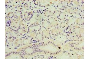 Immunohistochemistry of paraffin-embedded human pancreatic tissue using ABIN7169409 at dilution of 1:100 (SESN3 Antikörper  (AA 1-310))
