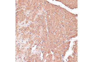 Immunohistochemistry of paraffin-embedded Mouse heart using FRMD6 antibody (ABIN6132194, ABIN6140773, ABIN6140774 and ABIN6225347) at dilution of 1:100 (40x lens). (FRMD6 Antikörper  (AA 405-614))