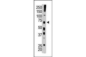 The USP22 polyclonal antibody  is used in Western blot to detect USP22 in mouse brain tissue lysate . (USP22 Antikörper  (C-Term))