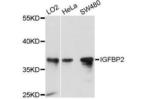 Western Blotting (WB) image for anti-Insulin-Like Growth Factor Binding Protein 2, 36kDa (IGFBP2) (AA 100-200) antibody (ABIN5663646)