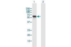 Western Blot analysis of NUP62 expression in transfected 293T cell line by NUP62 MaxPab polyclonal antibody. (NUP62 Antikörper  (AA 1-522))