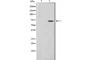 Western blot analysis on HuvEc cell lysate using Involucrin Antibody. (Involucrin Antikörper)
