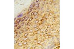 Immunohistochemistry analysis in formalin-fixed and paraffin-embedded human skin tissue reacted with LDHA Antibody (Center) Cat.