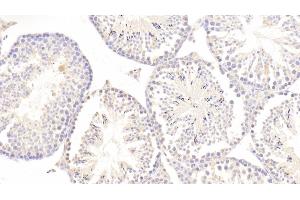 Detection of ERb in Mouse Testis Tissue using Polyclonal Antibody to Estrogen Receptor Beta (ERb) (ESR2 Antikörper  (AA 46-530))