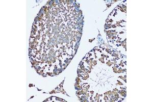 Immunohistochemistry of paraffin-embedded mouse testis using SQS/FDFT1 antibody (ABIN6130393, ABIN6140567, ABIN6140568 and ABIN6221824) at dilution of 1:100 (20x lens). (FDFT1 Antikörper  (AA 1-260))