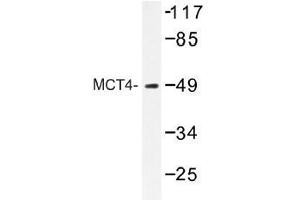 Image no. 1 for anti-Solute Carrier Family 16 (Monocarboxylic Acid Transporters), Member 3 (SLC16A3) antibody (ABIN317918) (SLC16A3 Antikörper)