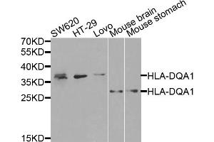 Western blot analysis of extracts of various cell lines, using HLA-DQA1 antibody (ABIN5971195) at 1/1000 dilution. (HLA-DQA1 Antikörper)