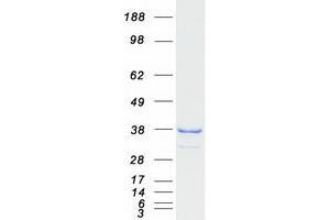 Western Blotting (WB) image for Coiled-Coil Domain Containing 44 (CCDC44) protein (Myc-DYKDDDDK Tag) (ABIN2713300)