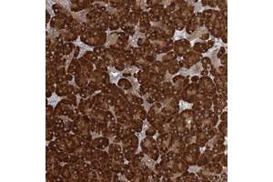 Immunohistochemical staining of human pancreas with FAM110C polyclonal antibody  shows strong cytoplasmic positivity in exocrine glandular cells at 1:200-1:500 dilution. (FAM110C Antikörper)