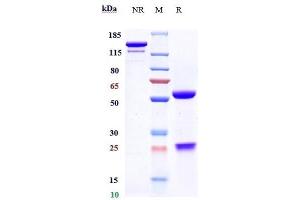 Anti-CCL5 / RANTES Reference Antibody (NI-0701) on SDS-PAGE under reducing (R) condition.