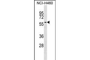 UGT2A3 antibody  (AA 324-353)