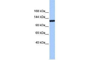 WB Suggested Anti-TEX2 Antibody Titration:  0. (TEX2 Antikörper  (N-Term))