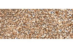 Immunohistochemistry of paraffin-embedded Human tonsil tissue using HOXC12 Polyclonal Antibody at dilution of 1:50(x200) (HOXC12 Antikörper)