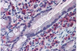 Rat Small Intestine: Formalin-Fixed, Paraffin-Embedded (FFPE) (CD163 Antikörper)