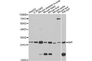 Western blot analysis of extracts of various cell lines, using MIP antibody (ABIN1873696) at 1:1000 dilution. (MIP Antikörper)