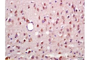 Formalin-fixed and paraffin embedded rat brain labeled with Anti-Phospho-RSK2 (Ser227) Polyclonal Antibody, Unconjugated (ABIN745268) at 1:200 followed by conjugation to the secondary antibody and DAB staining (RPS6KA3 Antikörper  (pSer227))