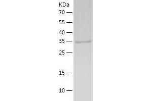 MNAT1 Protein (AA 2-309) (His tag)